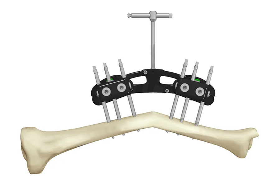 Fijador externo monolateral Huesos Largos · imagen 3