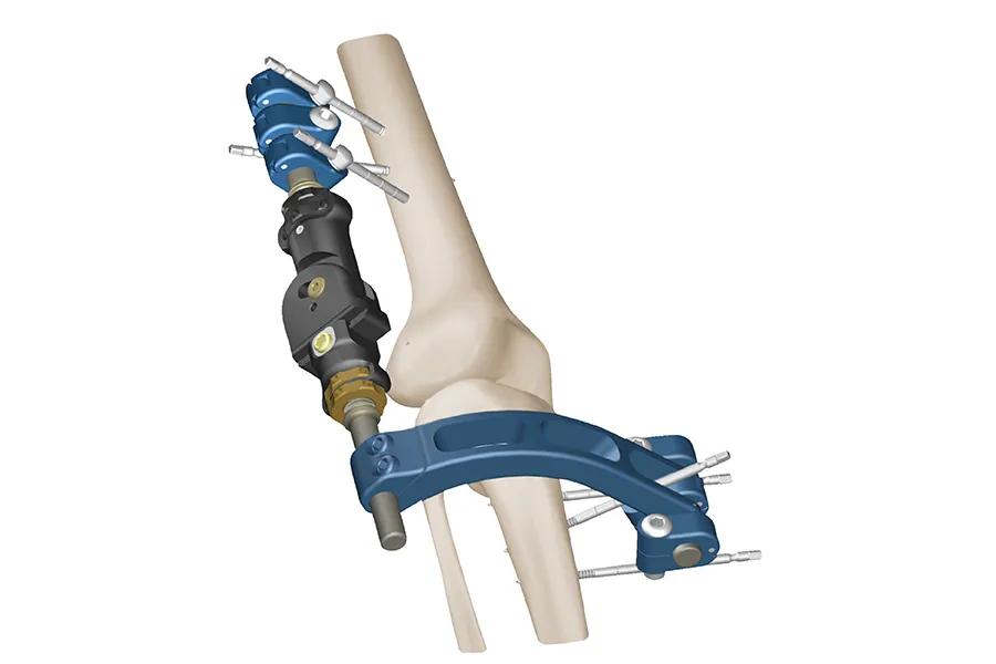 Fijador externo articulado para Rodilla · imagen 2