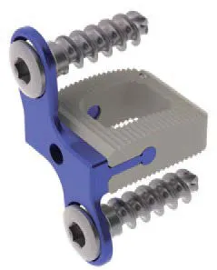 DOMINO – Sistema de jaula cervical · imagen 3